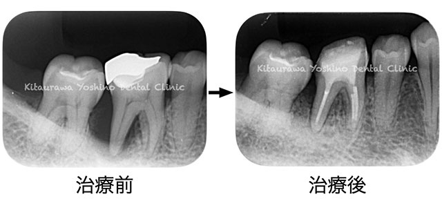 治療前・治療後