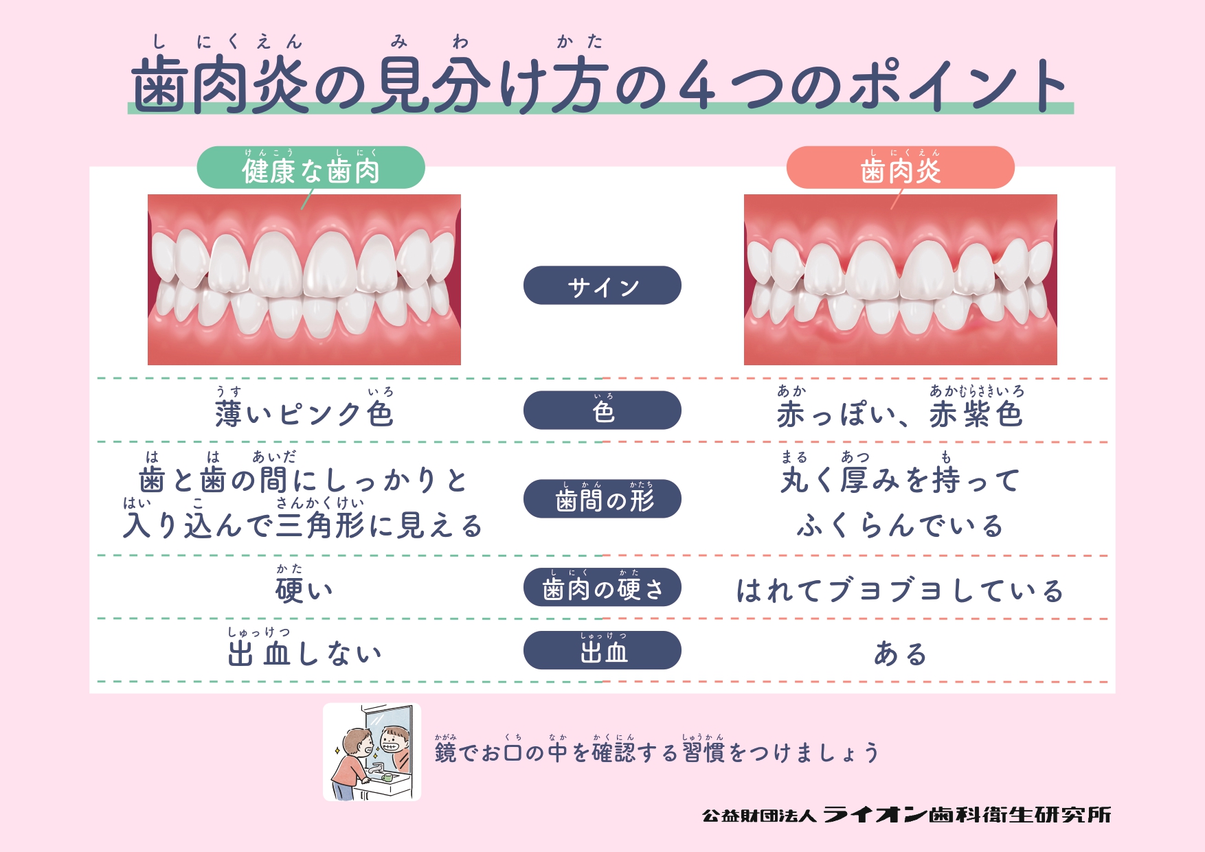 歯肉炎の見分け方の4つのポイント