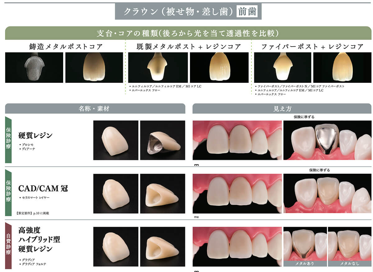 当院で取り扱う詰め物・被せ物の特徴04