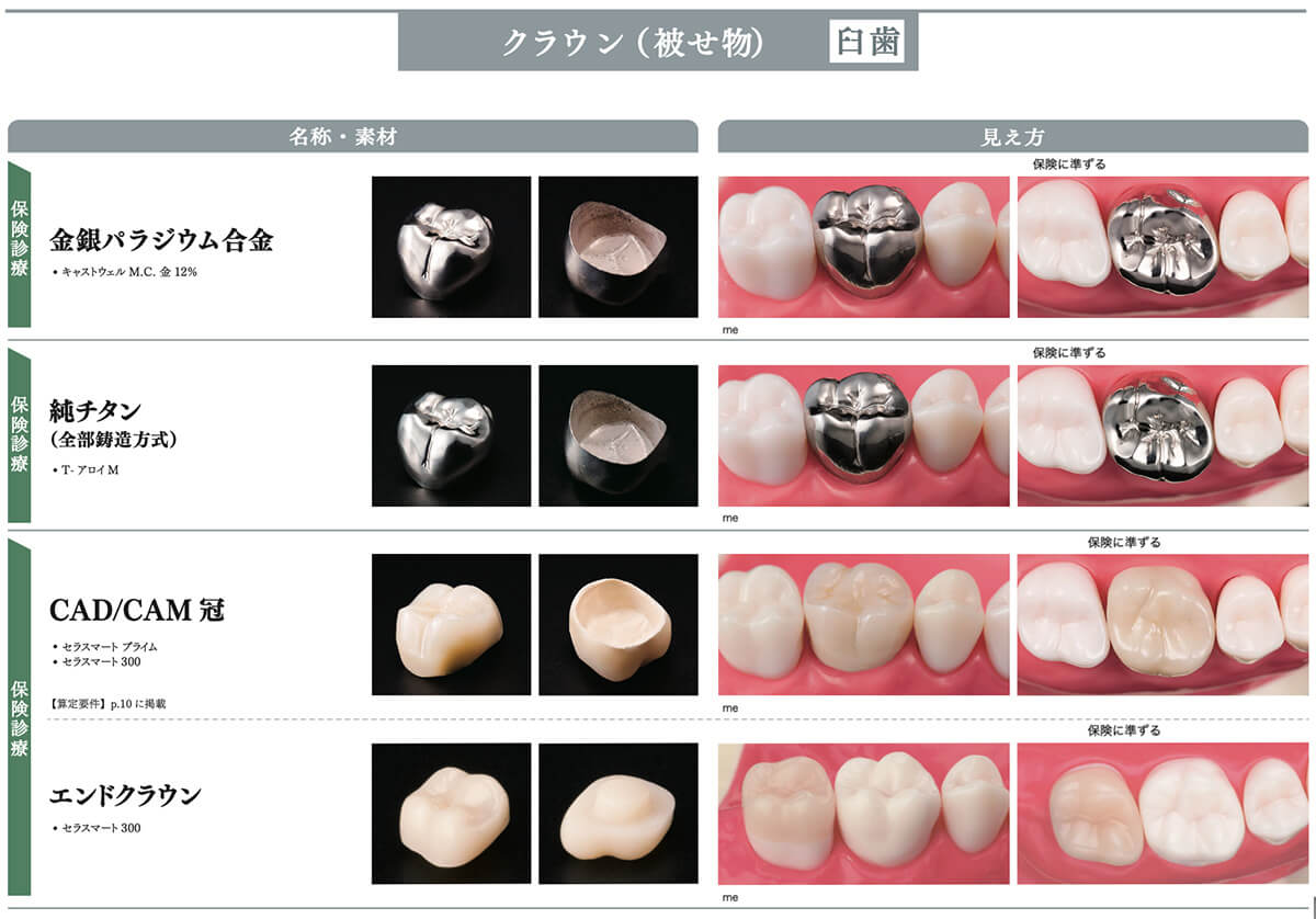 当院で取り扱う詰め物・被せ物の特徴06
