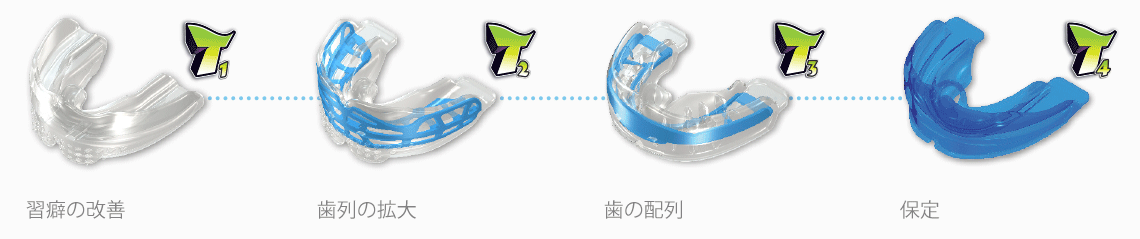 マイオブレース・システム 治療ステージ