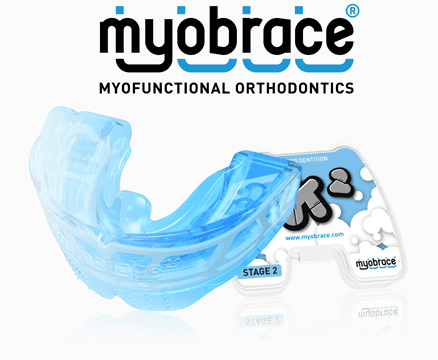 マイオブレース・システム